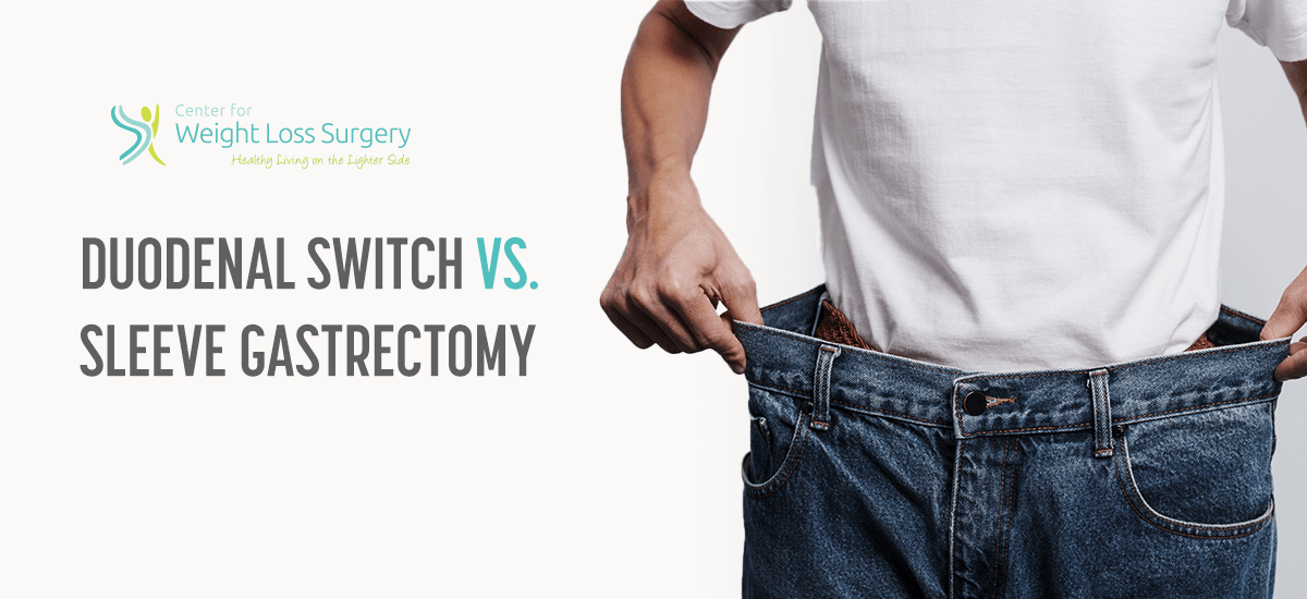 duodenal switch vs sleeve gastrectomy